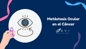 metástasis ocular en el cáncer