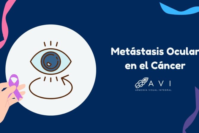 Metástasis ocular en el cáncer: lo que debes saber