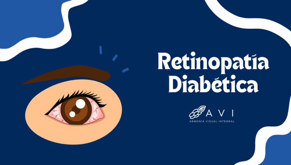 Retinopatía diabética: síntomas y detección temprana
